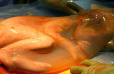 Imagen de bebe en zuron